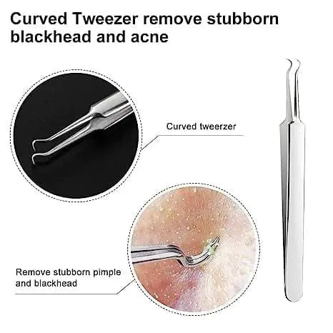 Professional Facial Blackhead Remover Tweezers (3Pcs+Box) Trendslana