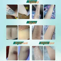 Tattoo and Scar Cover Up Patch (6 pcs) Trendslana