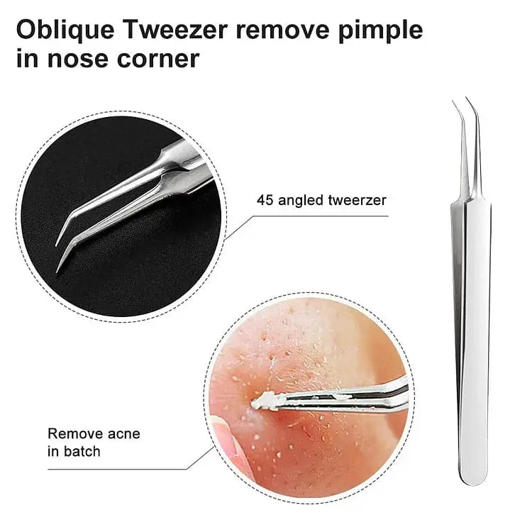 Professional Facial Blackhead Remover Tweezers (3Pcs+Box) Trendslana
