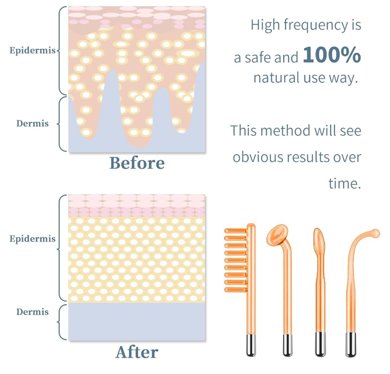 High Frequency Facial Machine