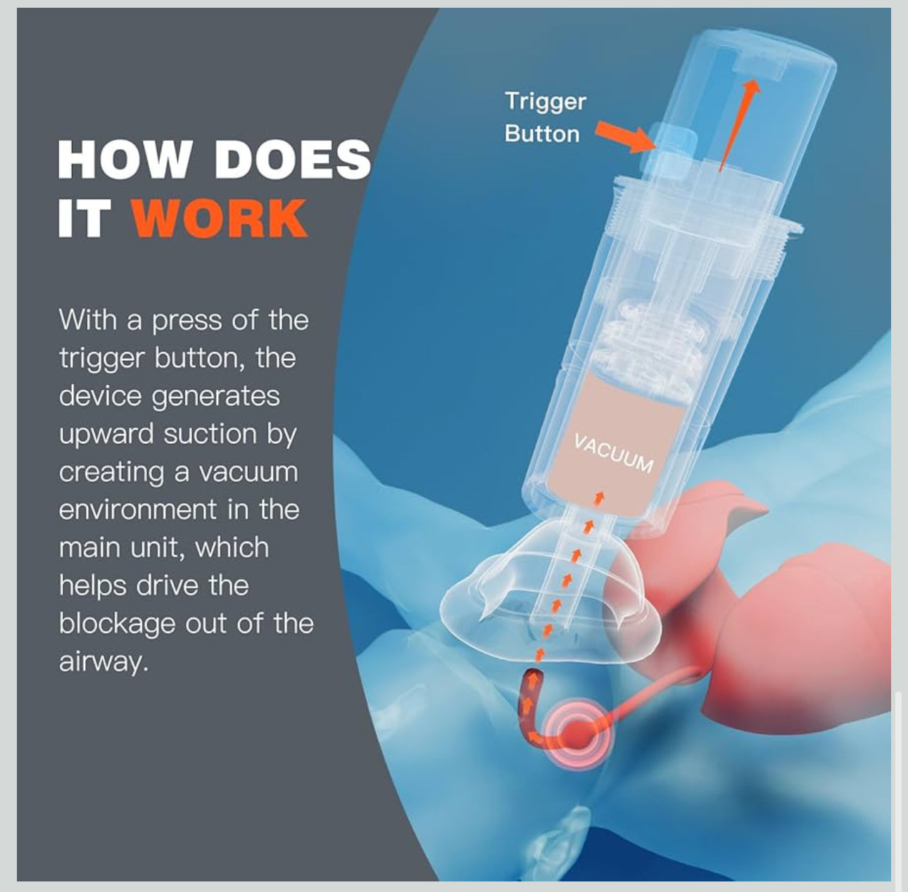 First Aid Choking Device