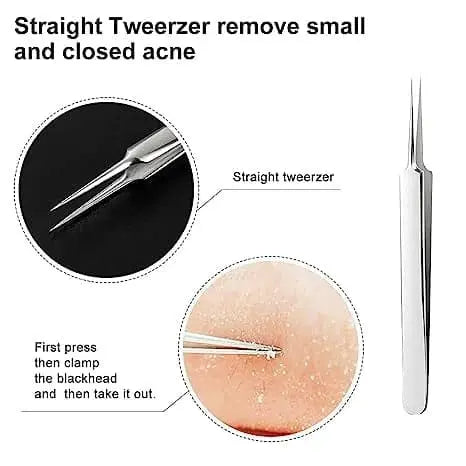 Professional Facial Blackhead Remover Tweezers (3Pcs+Box) Trendslana