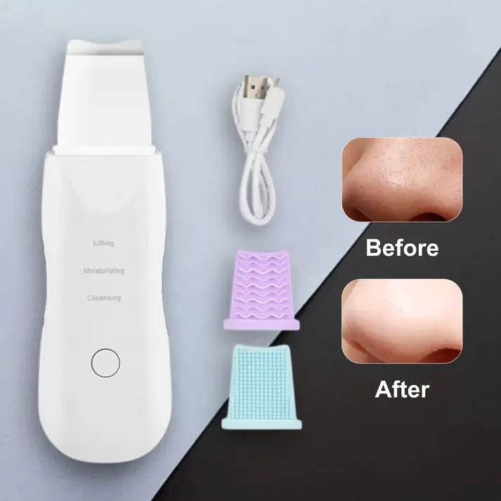 Ultrasonic Skin Scrubber Trendslana